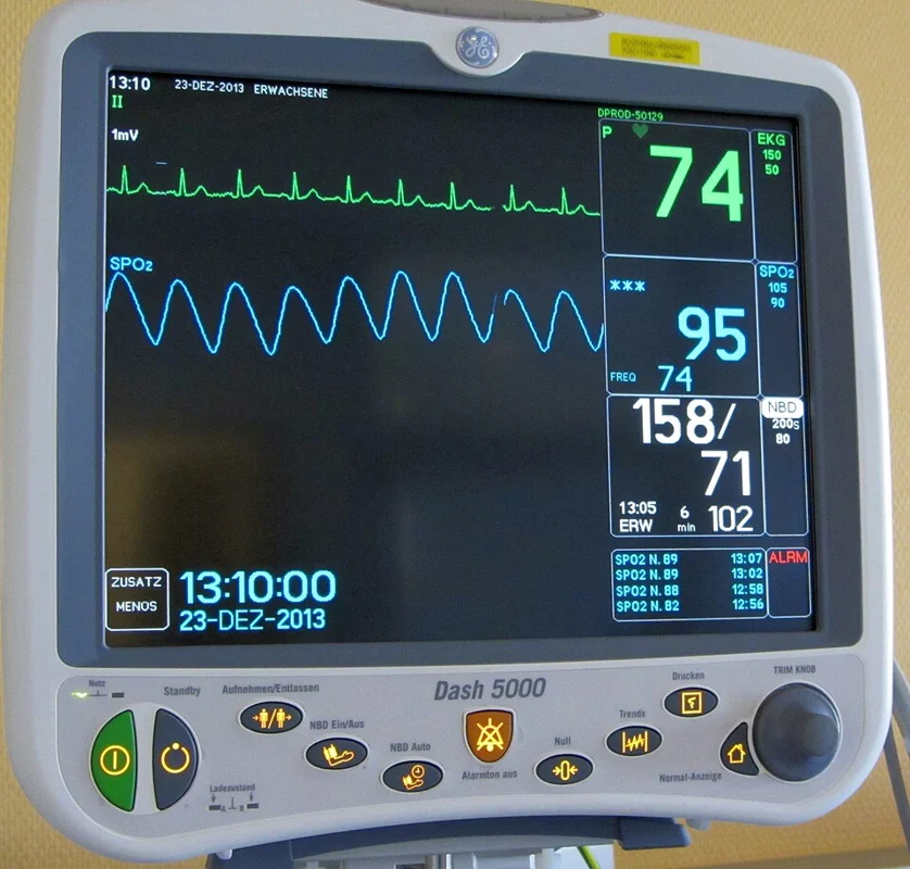 GE Dash 5000 medical monitor